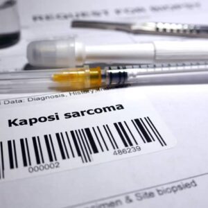 HHV-8 Kaposi’s sarcoma virus