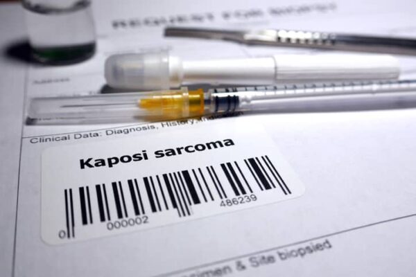 HHV-8 Kaposi’s sarcoma virus